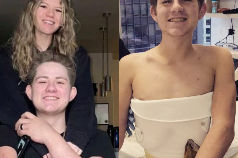 Milagre: jovem sobrevive após ter sido cortado ao meio e ganha prótese especial; veja video