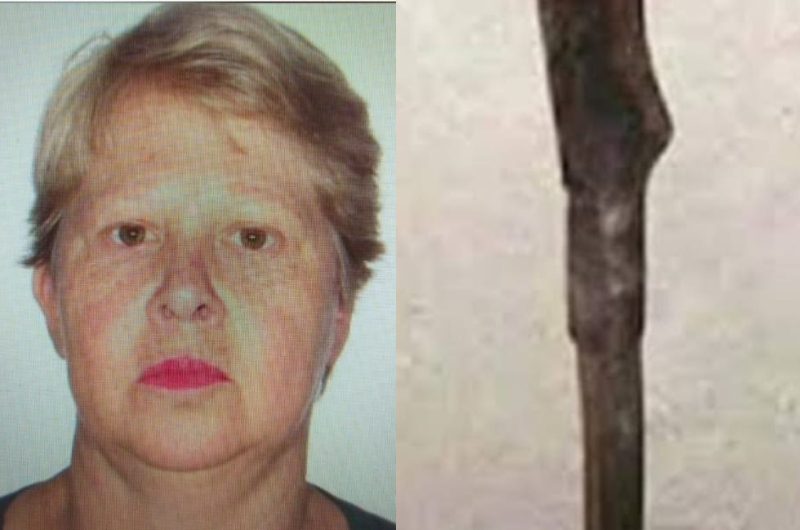 Mulher se joga na frente de golpe foice para defender marido e acaba perdendo o braço
