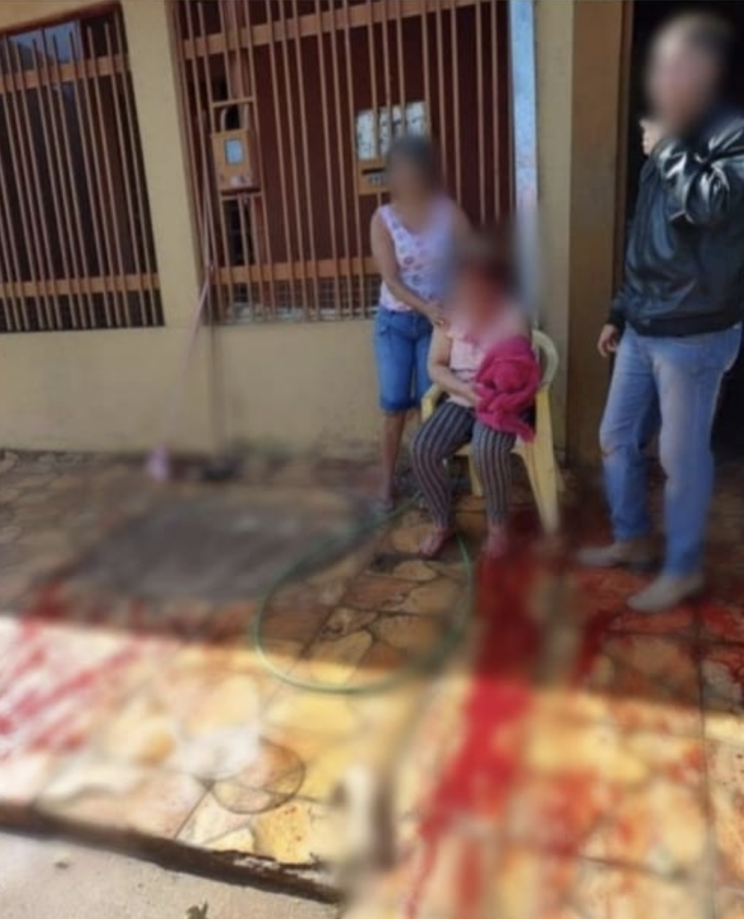 Mulher se joga na frente de golpe foice para defender marido e acaba perdendo o braço