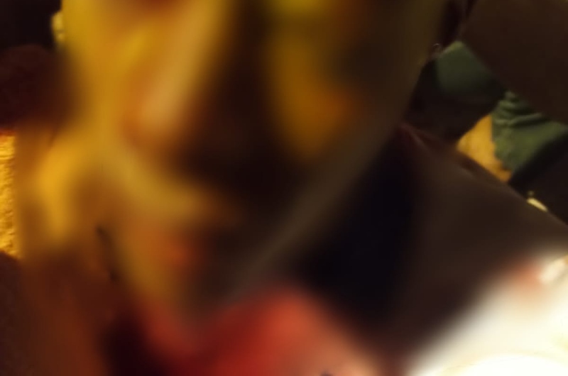 Jovem tem cabeça rachada no meio e fica com rosto desfigurado após tomar golpe de terçado; veja vídeo