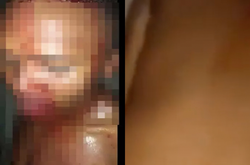 Estuprador tem ânus rasgado com cabo de vassoura dentro da cadeia; veja vídeo