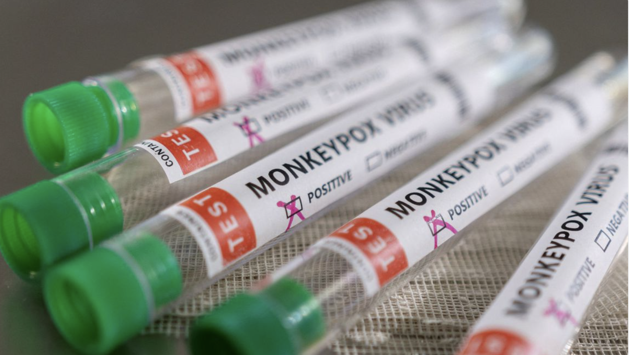 Anvisa orienta hospitais sobre casos de varíola dos macacos