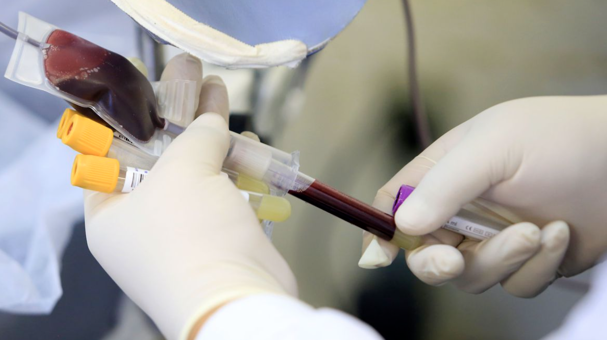 Ministério da Saúde lança campanha de incentivo à doação de sangue