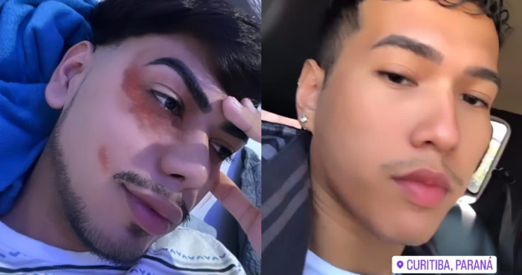 Namorado “chifrado” foge para Curitiba após blogueiro biscoitar usando filtro de olho roxo