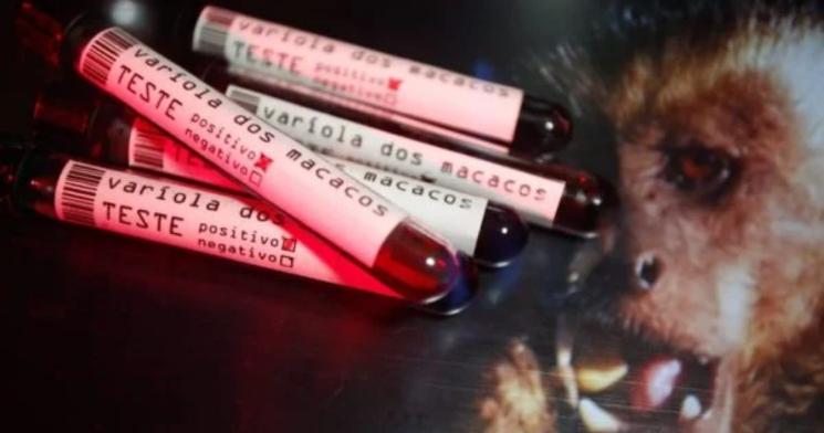 Varíola dos macacos: com 813 casos, Brasil tem situação “preocupante”