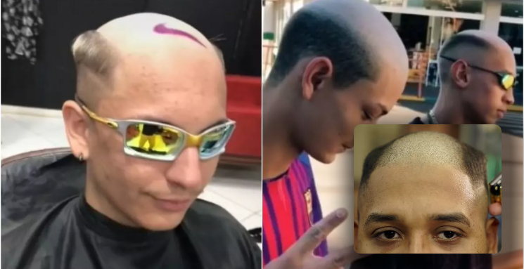 ‘Calvão de Cria’: nova “modinha” de corte de cabelo viraliza nas redes sociais e ganha adeptos