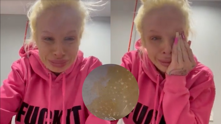 Famosa atriz fica desesperada após seu silicone estourar ‘do nada’: “Eu vou morrer!”; veja vídeo