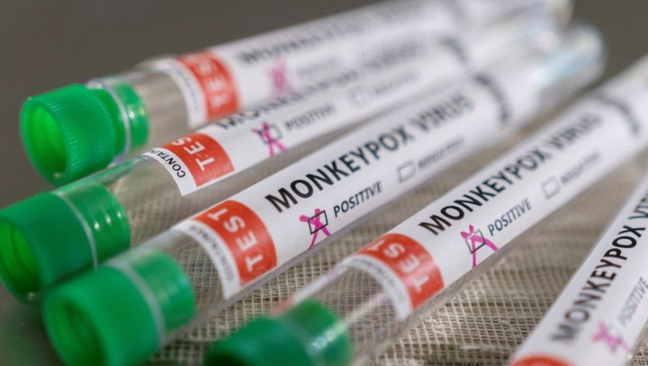 Ministro diz que Brasil terá antiviral para tratar varíola dos macacos