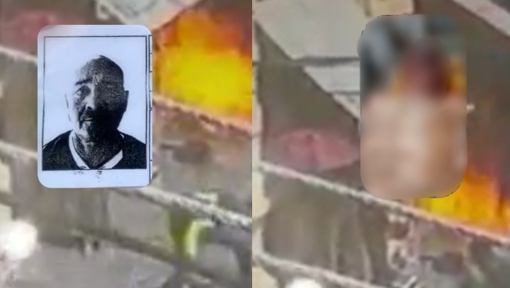 Venezuelano que ateou fogo em loteria de Manaus está com o rosto desfigurado; veja imagem