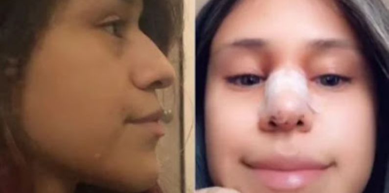 Após descobrir que estava sendo traída, Tiktoker obriga ex pagar sua cirurgia plástica