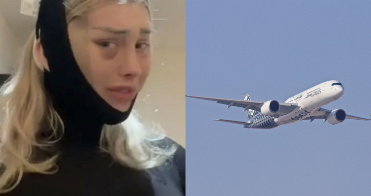 Cabeça de mulher abre durante vôo e motivo assusta; veja o vídeo