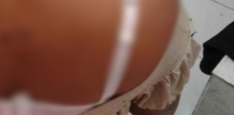 Revoltado por ter sido rejeitado na hora ‘H’, homem ataca adolescente de 17 anos com 14 facadas