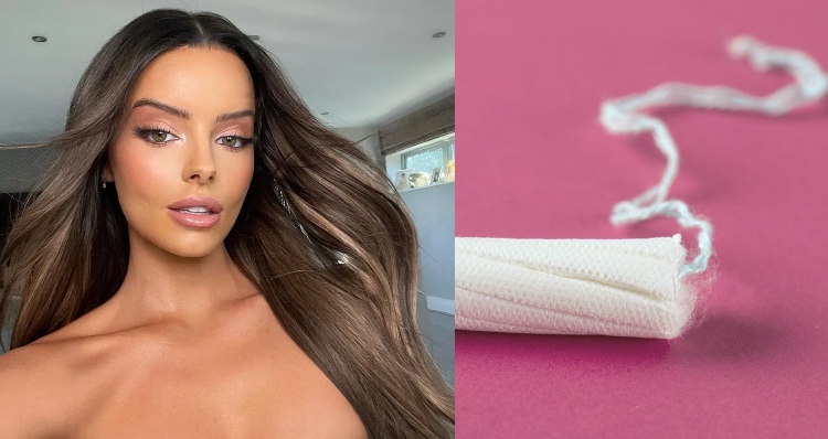 Modelo quase morre ao esquecer absorvente dentro dela por três meses