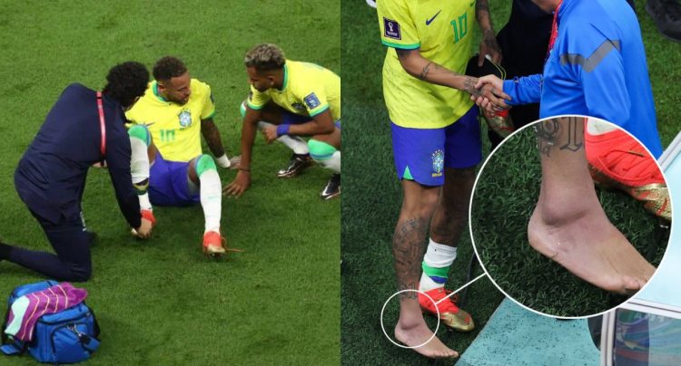 “Ainda não sabemos”, diz Médico da Seleção sobre a possibilidade de Neymar jogar contra a Suíça