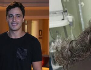 Ex-ator da Globo Thiago Rodrigues tem c0uro cabeludo arranc4do após ser vítima de assalto; veja