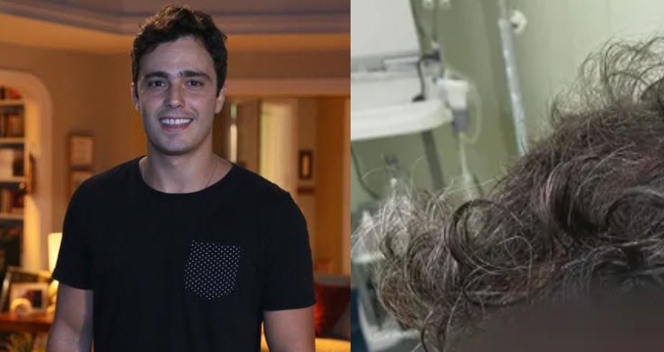 Ex-ator da Globo Thiago Rodrigues tem c0uro cabeludo arranc4do após ser vítima de assalto; veja