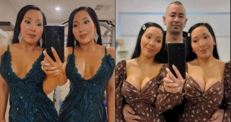 Gêmeas “mais idênticas do mundo” dividem namorado e se tornam milionárias na internet