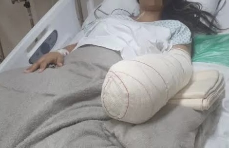 Mulher entra em hospital para ter bebê e acaba saindo com mão amputada
