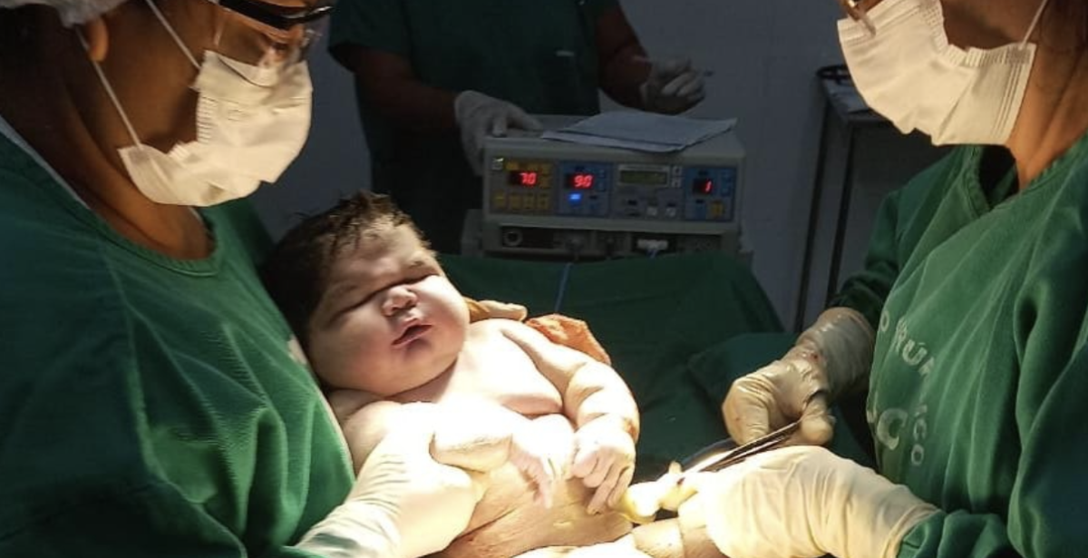 Bebê gigante: menino nasce com quase 8kg e é considerado o maior bebê nascido no Amazonas