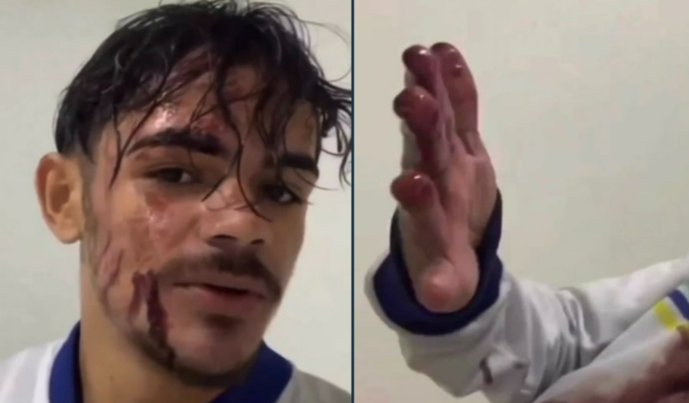 Cliente joga pote de açaí em motoboy por causa da demora e entregador diz: “estava chovendo”; veja vídeo