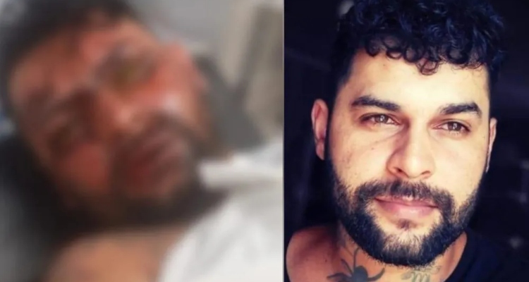 Mulher joga soda cáustica no rosto de ex e rezava para ele ficar cego; veja vídeo