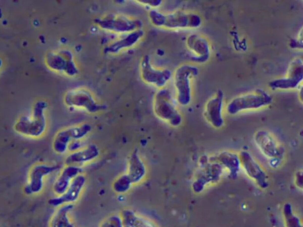 Homem morre após lavar o rosto e contrair “ameba comedora de cérebro”