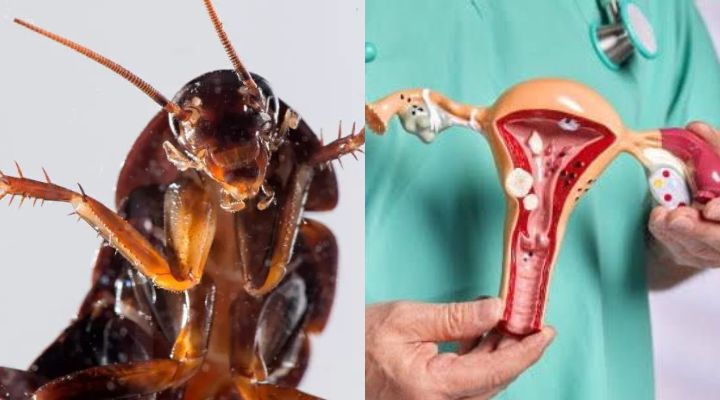 Barata é encontrada dentro de vagin4 de mulher
