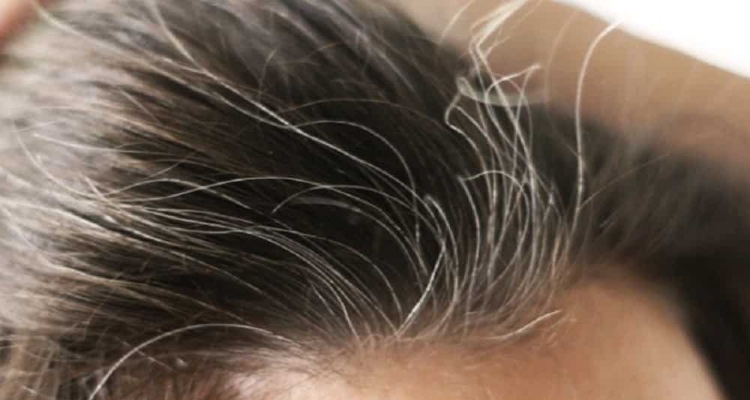 Cientistas descobrem como evitar o surgimento de cabelos brancos; confira