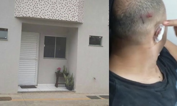 Inquilino diz que foi espancad0 por dono de ‘apê’ e denuncia homofobia: ‘Falou que viad0 merece apanhar’; veja