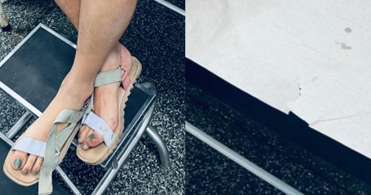 Mulher fica com várias lesões após ser espancad4 pelo namorado no interior do Amazonas