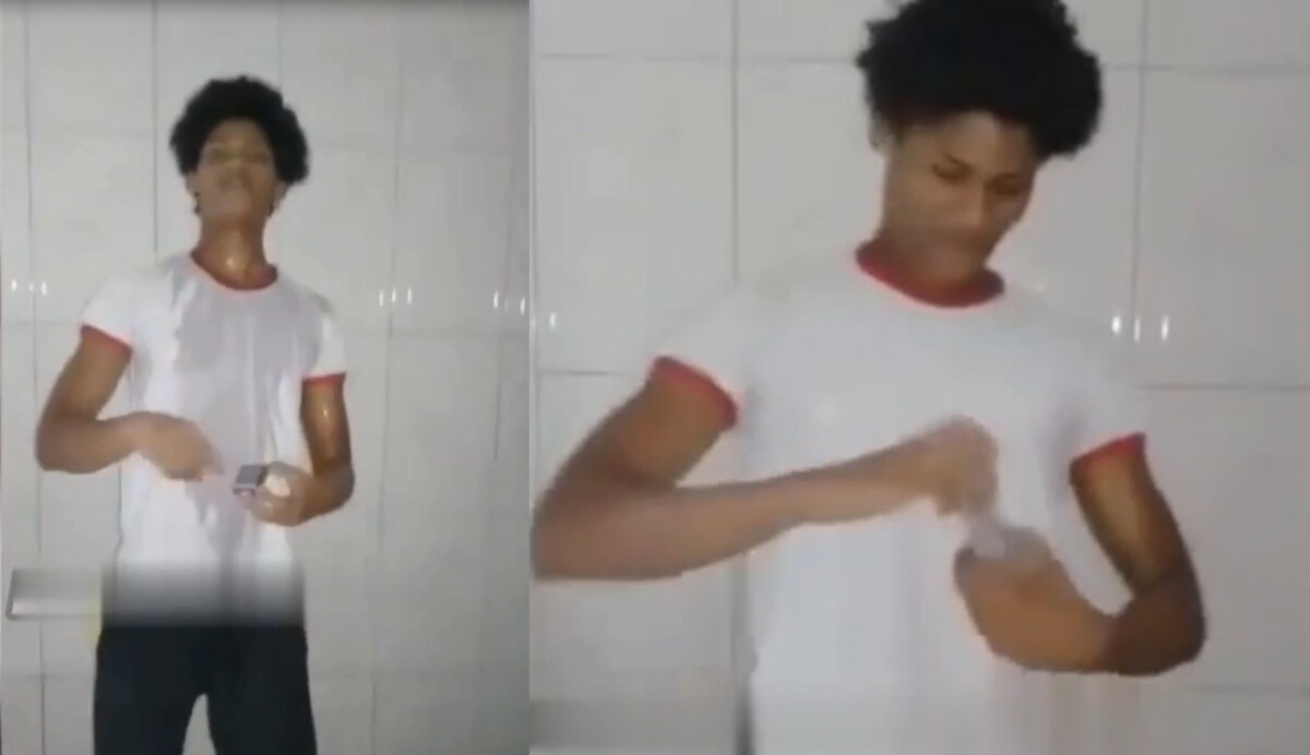 Jovem atei4 f0go no próprio corpo pra viralizar no Tik Tok; veja vídeo