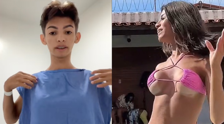 Irmão Carlos Emanuel, ex Catty Lares, passa por cirurgia para retirar suas próteses de silicone; veja vídeo