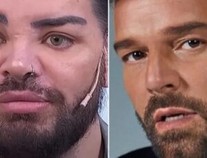 Argentino faz 30 cirurgias plásticas para ficar parecido com Ricky Martin