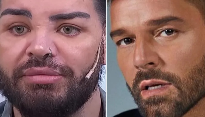 Argentino faz 30 cirurgias plásticas para ficar parecido com Ricky Martin; veja antes e depois