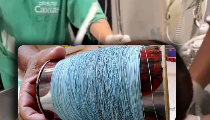 “Inacreditável”: diz médico aterrorizado com estrago que Linha de Cerol causou em rosto de paciente; veja vídeo