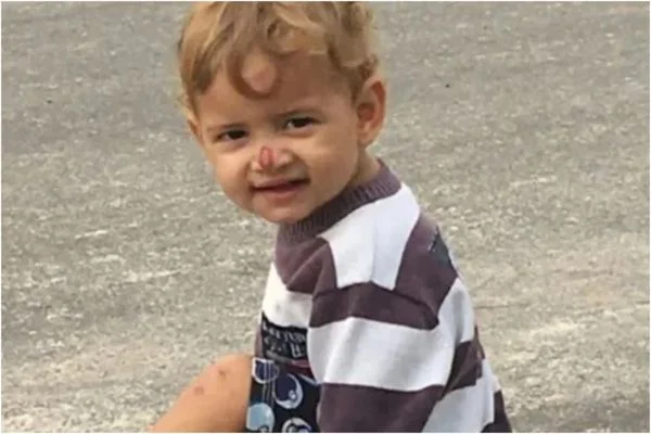 Tragédia: ataque brut4l de pitbull mat4 criança de 2 anos