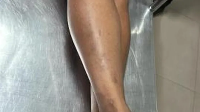 Garota de programa é agredida com tijoladas após recusar fazer programa por R$10