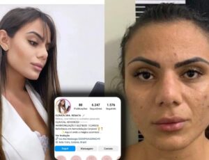 Falsa médica, especializada em 'harmonização e glúteos, é presa por arriscar vida de clientes; veja