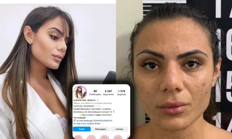 Falsa médica, especializada em ‘harmonização e glúteos, é presa por arriscar vida de clientes; veja