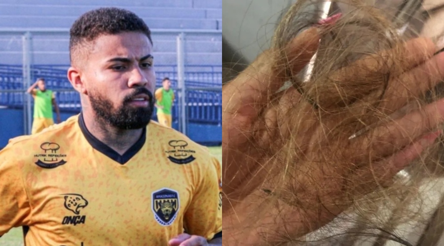 Jovem denuncia jogador Douglas do Amazonas FC após levar surr4 vi0lenta