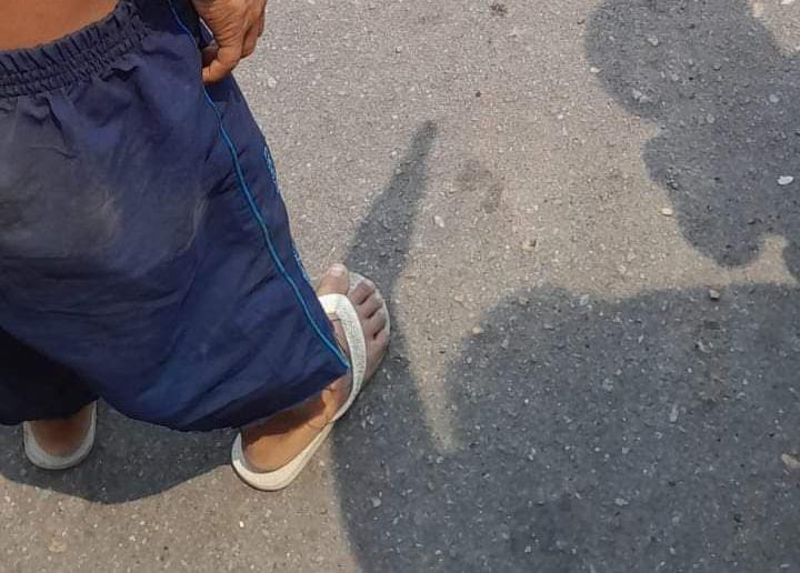 Motociclista fica todo quebrad0 após colidir contra outro veículo no AM; veja imagem