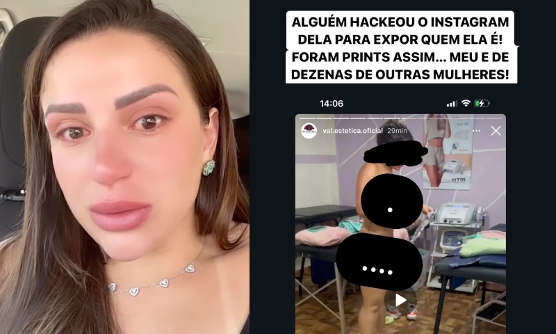 Influencer chora após ser filmada nua sem autorização por clínica de estética; veja vídeo