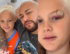 Filho de Neymar sofre acidente e aparece com olho roxo: "Começamos bem 2024"; veja vídeo