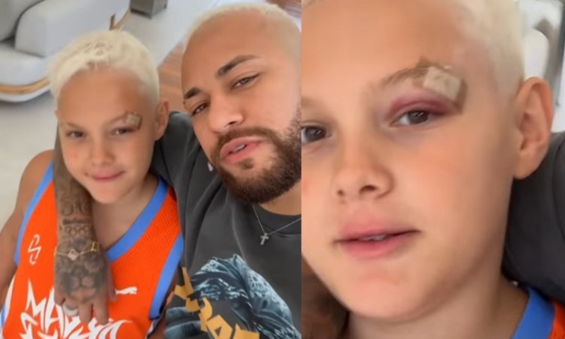 Filho de Neymar sofre acidente e aparece com olho roxo: “Começamos bem 2024”; veja vídeo