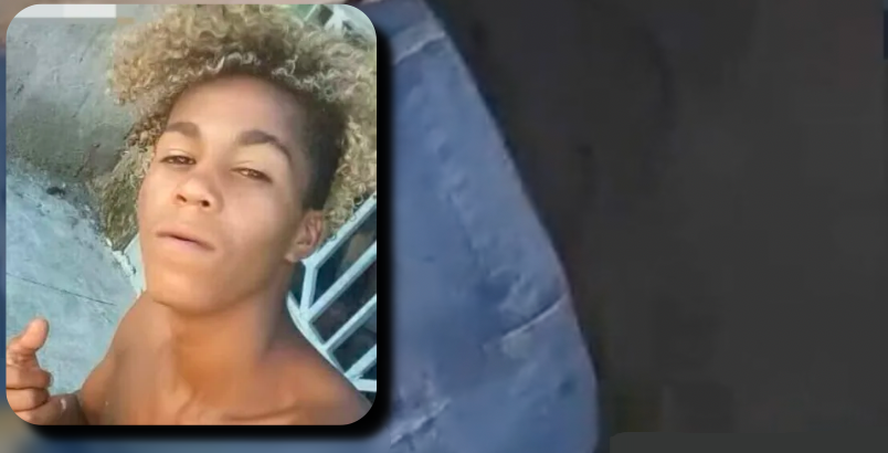Jovem tem c4beça fati4da pelo próprio amigo durante bebedeira; veja vídeo