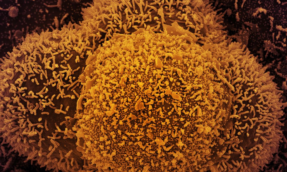 Casos graves e m0rte: nova subvariante da covid-19 chega ao Brasil