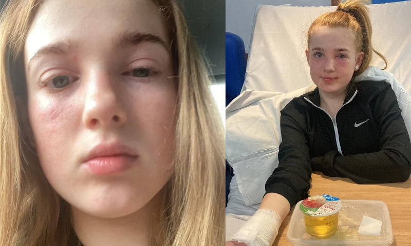 Menina de 13 anos quase fica cega após imitar tutorial de “skincare” do TikTok; veja