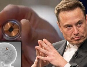 Neuralink realiza 1º implante de chip no cérebro humano, diz Elon Musk; veja vídeo
