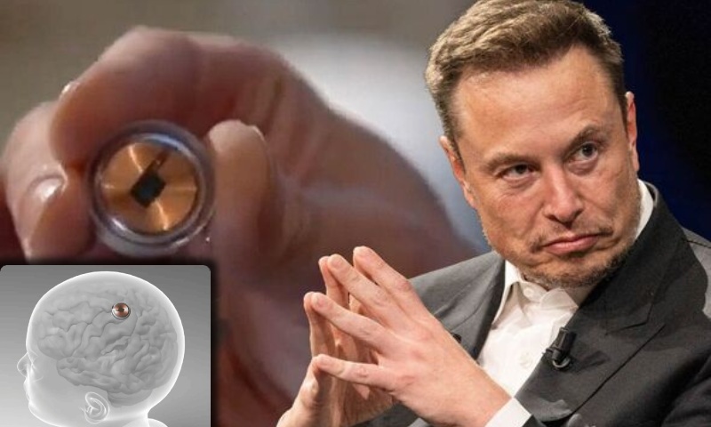 Neuralink realiza 1º implante de chip no cérebro humano, diz Elon Musk; veja vídeo