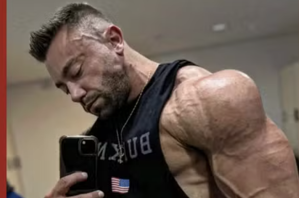 Personal trainer e influencer de 34 anos que nasceu com um rim morre dois meses após entrar na fila por transplante